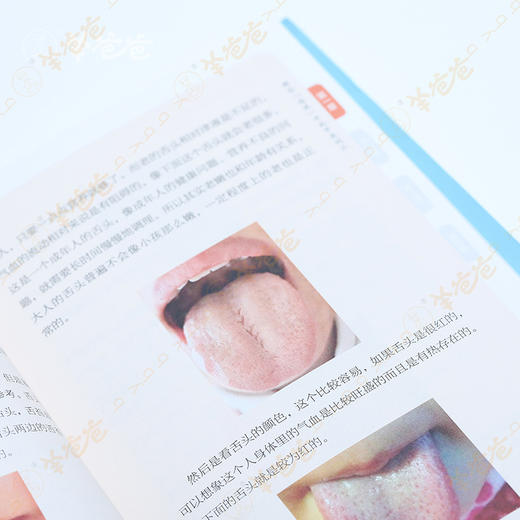 系列书【孩子生病都带着礼物2】杨千栋推荐羊爸爸丛书|你和孩子之间美好的礼物 商品图5