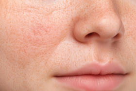 冬天晒太阳暖暖的，当心紫外线伤害皮肤！有它就不怕了