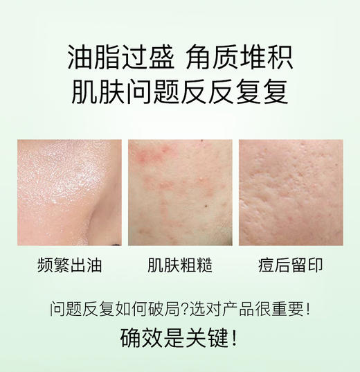 [新品]Anti O tempo 壬二酸精华液 26mL 商品图2