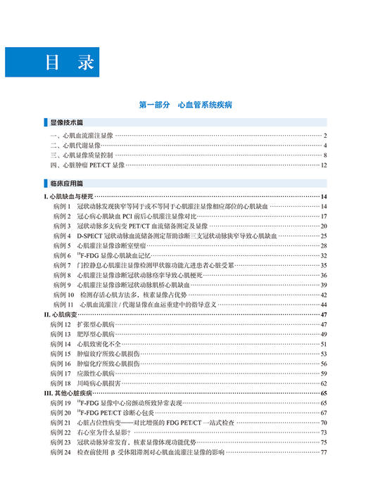 心血管与呼吸系统疾病核素显像临床应用 核素显像临床应用实例系列丛书 王雪梅 杨敏福 王茜主编 北京大学医学出版社9787565930492 商品图2
