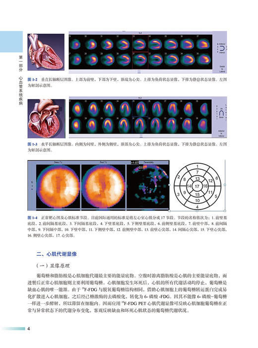 心血管与呼吸系统疾病核素显像临床应用 核素显像临床应用实例系列丛书 王雪梅 杨敏福 王茜主编 北京大学医学出版社9787565930492 商品图3