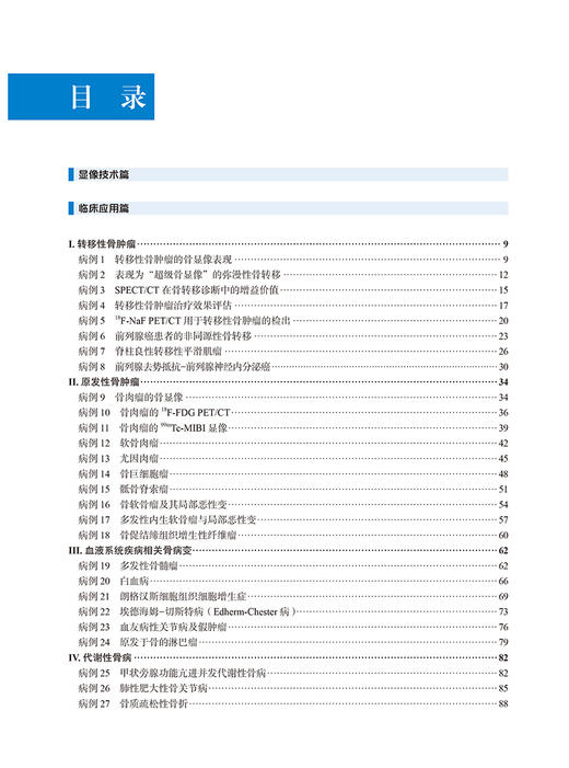 骨骼系统疾病核素显像临床应用 核素显像临床应用实例系列丛书 核医学意思规范化培训指导用书 北京大学医学出版社9787565930454  商品图4