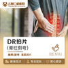 DR拍片（脊柱侧弯） 商品缩略图0