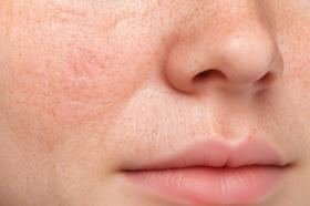 想抗衰? 胶原蛋白这样喝才有效！