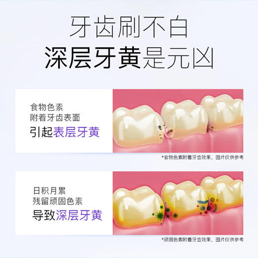 舒客酵素牙膏组合装青柠120g*2+防蛀固齿140g*2清新美白牙齿含氟防蛀 商品图2