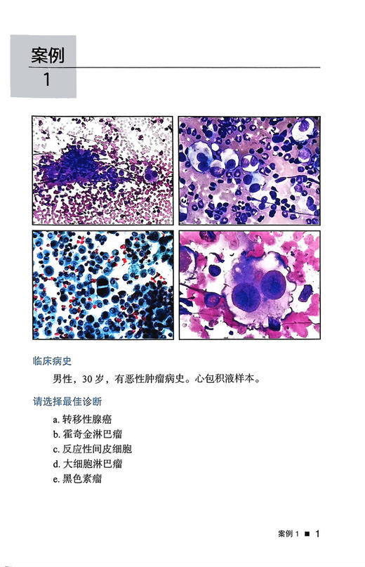 细胞病理学病例精粹 陆霓虹 杜映荣主译 液体脱落细胞学细针穿刺案例 细胞学特征图片病史诊断选择及答案解析 北京大学医学出版社 商品图3