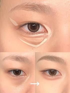 0️⃣基础凹陷型泪沟、黑眼圈遮瑕大法！