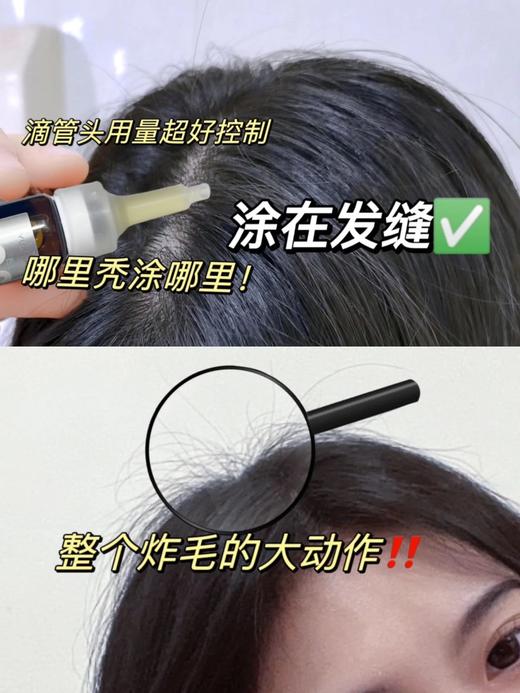 真的可以长头发❗️协和医美中心联合研制！【之研防脱育发液】国家育发特证，成分安全温和，熬夜加班，发际线后移，产后脱发等，都给我冲！ 商品图4