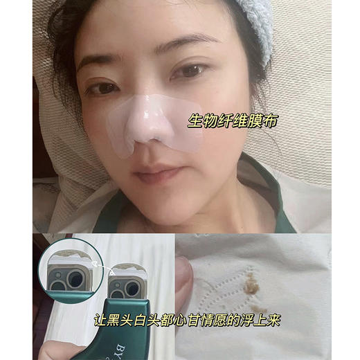 送黑头铲 柏翠丝鼻贴去黑头白头收缩毛孔不撕拉温和 商品图3