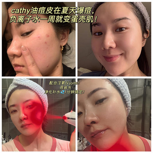 年度黑科技奖！古蔻负离子保湿水细胞还原水小分子0.1渗透自由基 商品图3