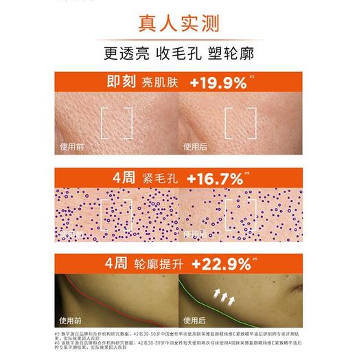 严选 | 欧莱雅真C瓶精华液 30ml/瓶 高倍抗氧 吸收更快 商品图2