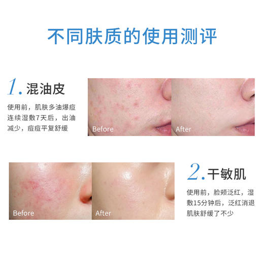 pepe猫日本安润奈orien nano肌断食水补水修护敏感肌友好500ml 商品图3