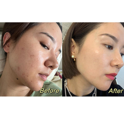 Prof.Royal美赋乐活虾青素烟酰胺樱桃维c美丽白皮肤 商品图1