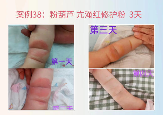 【芷御坊亢淹宝宝多效粉】一瓶零售价68元，活动立减13元，实收款55元。 商品图4