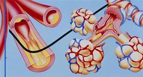  血管堵塞时，会频频发出这7个“警告”，要重视起来！艾灸教你预防血管堵塞 