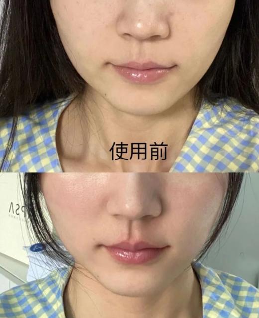 【1.12大牌再降价】宙斯 缪斯一代Miss Arrivo Ghost美容仪器小魅影提拉紧致 商品图4