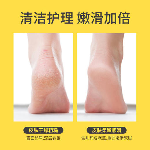 匹奇（PRITECH） 电动磨脚器 自吸尘修足器脚皮机M6黄色 商品图3