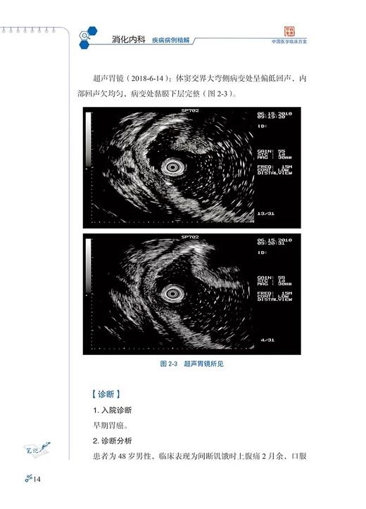 首都医科大学附属北京友谊医院消化内科疾病病例精解 张澍田 吴咏冬 中国医学临床百家病例精解 科学技术文献出版社9787518998517 商品图3