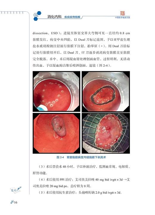 首都医科大学附属北京友谊医院消化内科疾病病例精解 张澍田 吴咏冬 中国医学临床百家病例精解 科学技术文献出版社9787518998517 商品图4