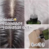 【清仓好价】新珐24育发防脱新髮头皮毛囊营养生发液育发液100ml 商品缩略图2