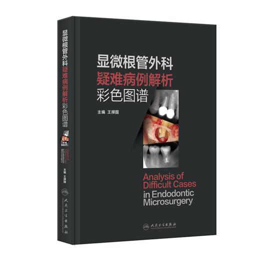 显微根管外科疑难病例解析彩色图谱 商品图0
