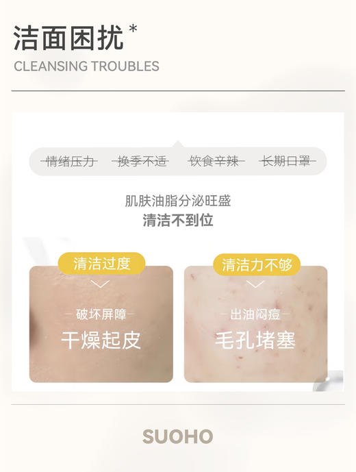 TOPC益生元氨基酸洁面膏洁面乳洗面奶｜祛痘膏同团队研发，起泡丰盈 清爽干净 不紧绷 不假滑 温和不刺JI（110g)更换新包装 商品图4
