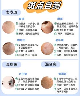 祛斑前一定要知道这件事！