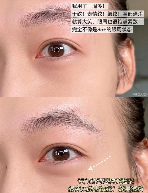 VASSARETTE·阿玛尼黑钥匙7肽精修眼霜紧致补水滋润长效修护 商品图7