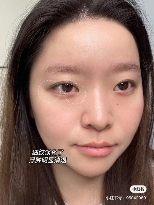 【1.20王炸割肉价】雅诗兰黛新款二合一液体眼绷带精华眼霜15ml（效期至24.3-4） 商品图6