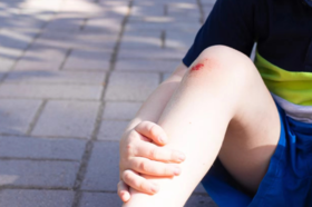 小朋友外伤后，身上留下疤痕怎么办？