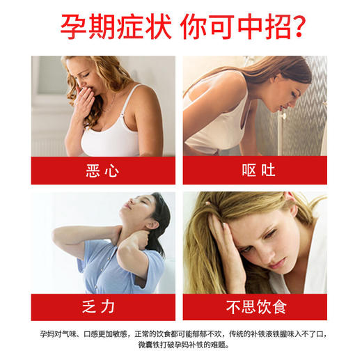 【保税仓】意大利UGA 意之宝孕妇补铁剂女性儿童缺铁产后孕妇型20小包/盒 商品图2