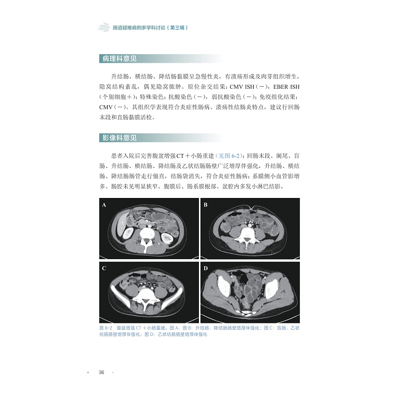 样章,肠道疑难病例多学科讨论(第三辑)_004.jpg
