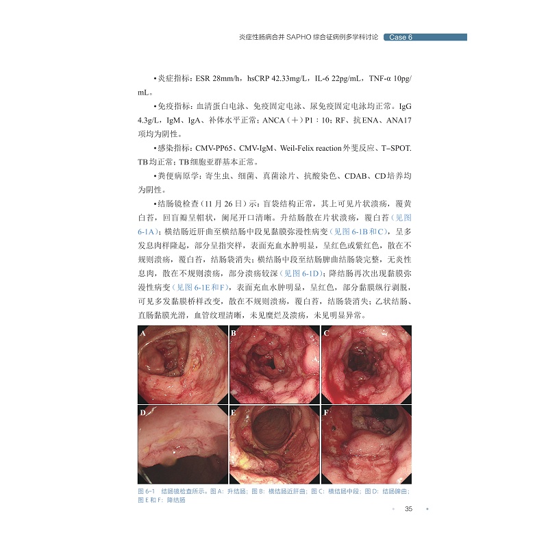 样章,肠道疑难病例多学科讨论(第三辑)_003.jpg