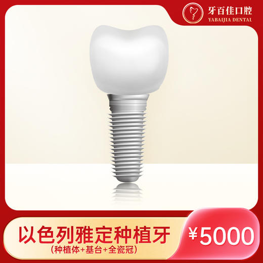 J牙百佳以色列雅定种植牙（电子券到店核销） 商品图0