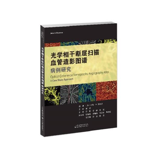 光学相干断层扫描血管造影图谱 病例研究 一本内容丰富实用的OCTA指导手册配有100余幅高质量图片天津科技翻译出版公9787543343757 商品图1