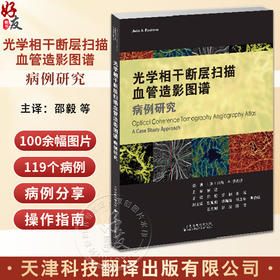 光学相干断层扫描血管造影图谱 病例研究 一本内容丰富实用的OCTA指导手册配有100余幅高质量图片天津科技翻译出版公9787543343757