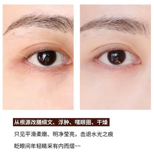 雅诗兰黛小棕瓶特润修护液体眼绷带精华15ml 商品图4