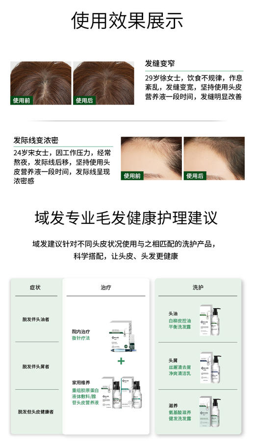腺苷头皮营养液/头皮营养液 商品图5