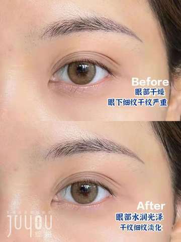 绽妍维A醇多重修护眼霜 15g/支 商品图4