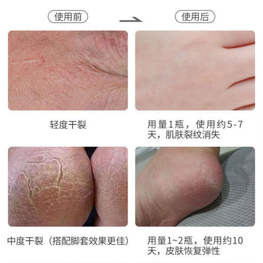 「买三送一！手足防裂小绿膏」ALICEVA手足防裂小绿膏 滋润保湿防冻干裂改善粗糙手足皴裂膏美容护肤 商品图2