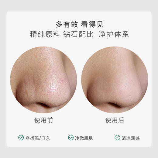 【三八节】茶树去黑头精华套组重度黑头选我 商品图2