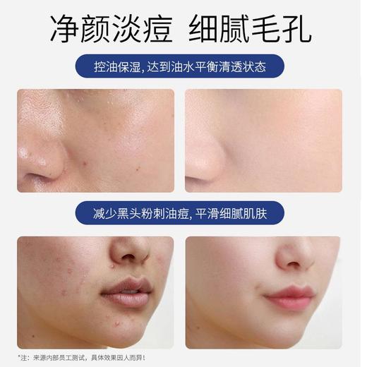 蒙投丽雪0.4%水杨酸淡痘精华液 控油修护淡化痘印精华原液护肤品 商品图2