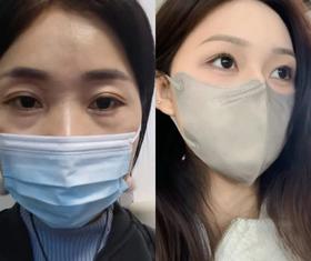  嗓子又干又痒、还有痰？最管用的水果不是枇杷、雪梨，而是它，条件允许建议多吃！ 