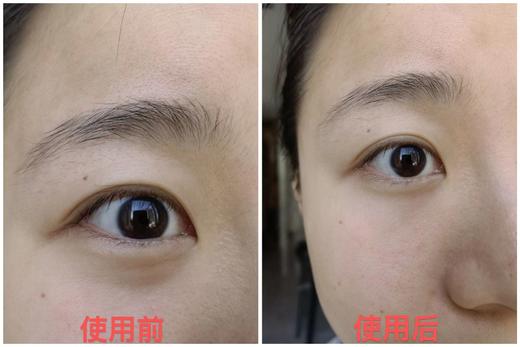 【这价只在春节有】兰蔻菁纯眼部精华5ml（限24年8月） 商品图3