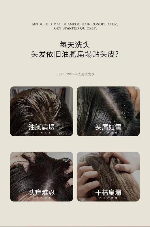 大容量三井巨无霸洗发水 头痒、头屑、大油头就用它‼️ 商品图3