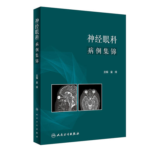 神经眼科病例集锦 附多幅眼底图及影像学图谱 眼科疾病神经视光学青光眼闪光疾病判断与典型病例集锦 人民卫生出版社9787117348188 商品图1