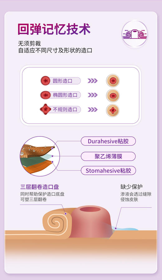 康维德NATURA两件式尿路造口小便袋旋塞式可塑尿路防漏套装1+1 商品图3