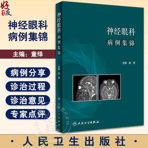 神经眼科病例集锦 附多幅眼底图及影像学图谱 眼科疾病神经视光学青光眼闪光疾病判断与典型病例集锦 人民卫生出版社9787117348188 商品图0