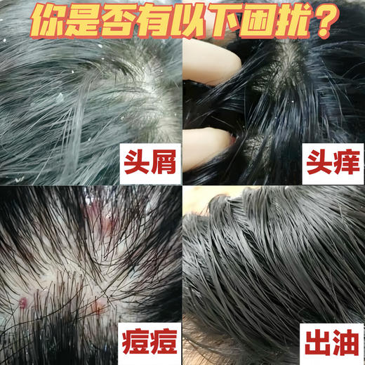 大容量三井巨无霸洗发水 头痒、头屑、大油头就用它‼️ 商品图7