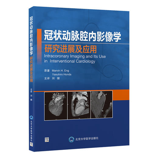 冠状动脉腔内影像学研究进展及应用 刘健 主译 本书涵盖冠状动脉腔内影像学领域主要内容重要进展 北京大学医学出版9787565930614  商品图1